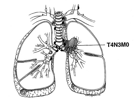  of structures such as the trachea, esophagus, heart, and major vessels, 