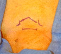 [Illustration:  Figure 1]