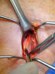 [Illustration:  Figure 4]