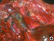 View Figure 11A larger