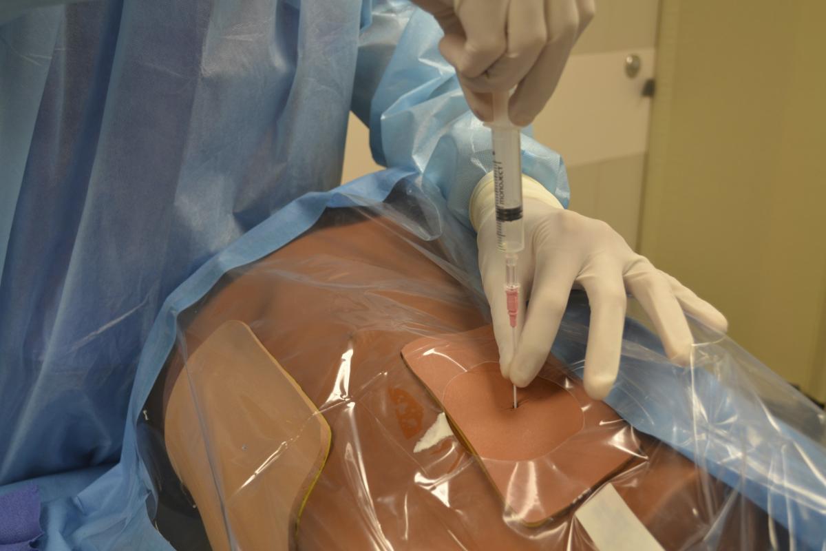 Percutaneous Catheter for Spontaneous Pneumothorax