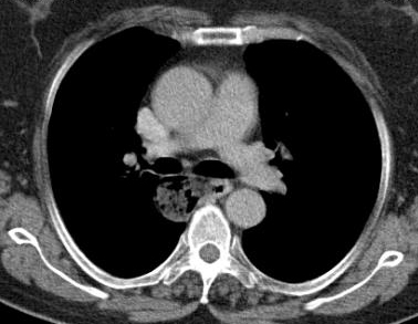 View Figure 2 larger