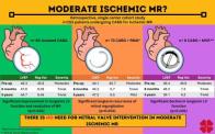 Moderate Ischemic MR